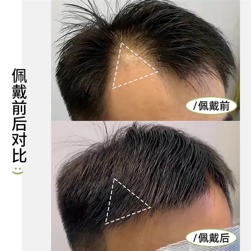 男士假刘海片鬓角补发假发片男女全真人发m型前额发际线假发贴片