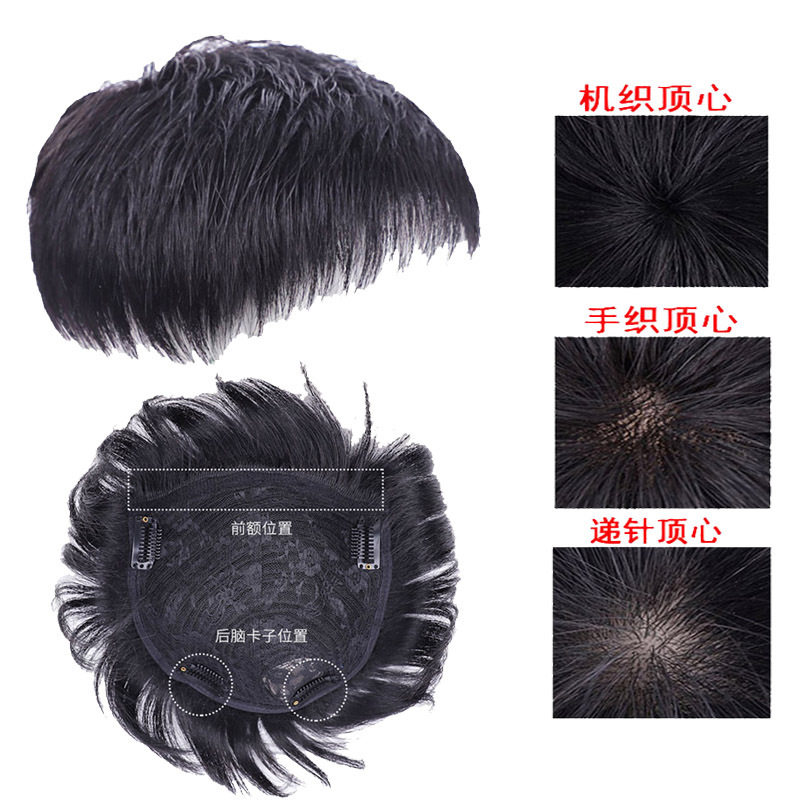 假发男头顶前额补发片寸头短发中老年翻盖真发发际线隐形光头发套