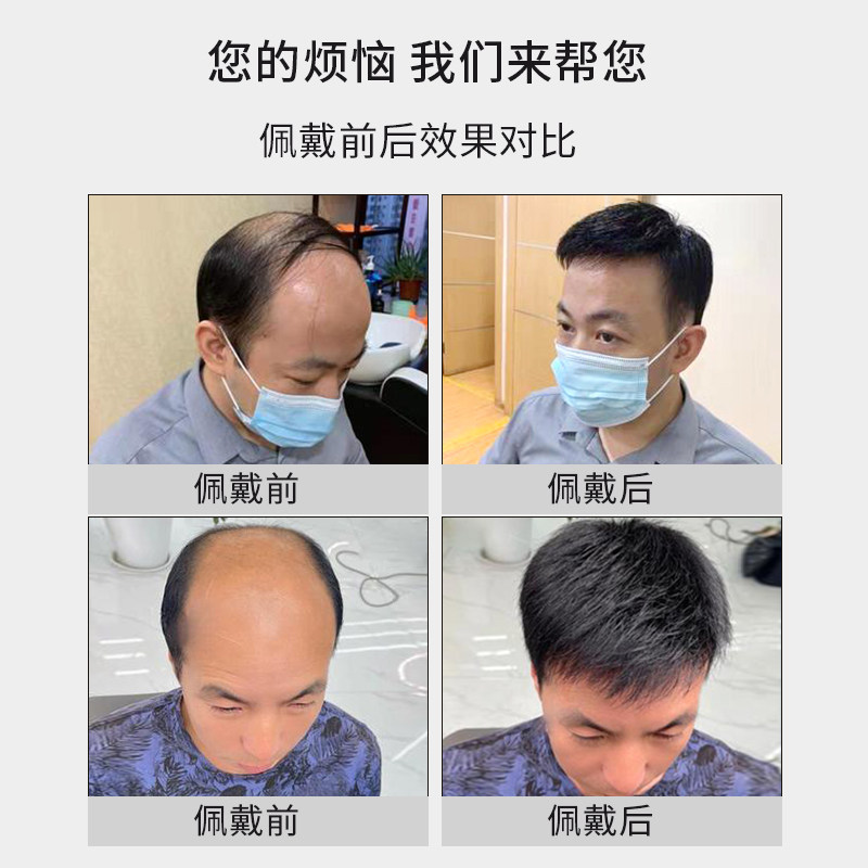 假发男短发真发全真人发轻薄男士假发毛寸头顶无痕韩版帅气补发片