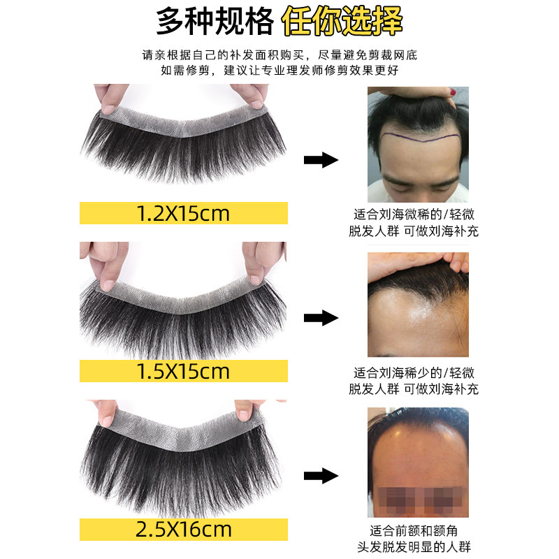 发际线假发贴男士前额隐形无痕真发补发片生物头皮m型精修浏海片