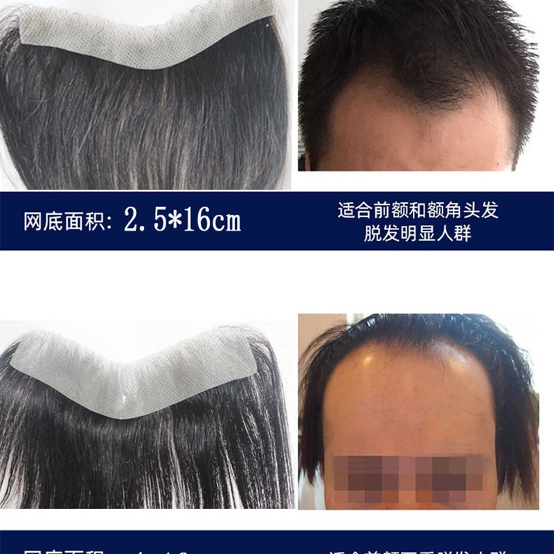 发际线假发贴男士前额真发补发片假刘海男隐形生物头皮M型假发片