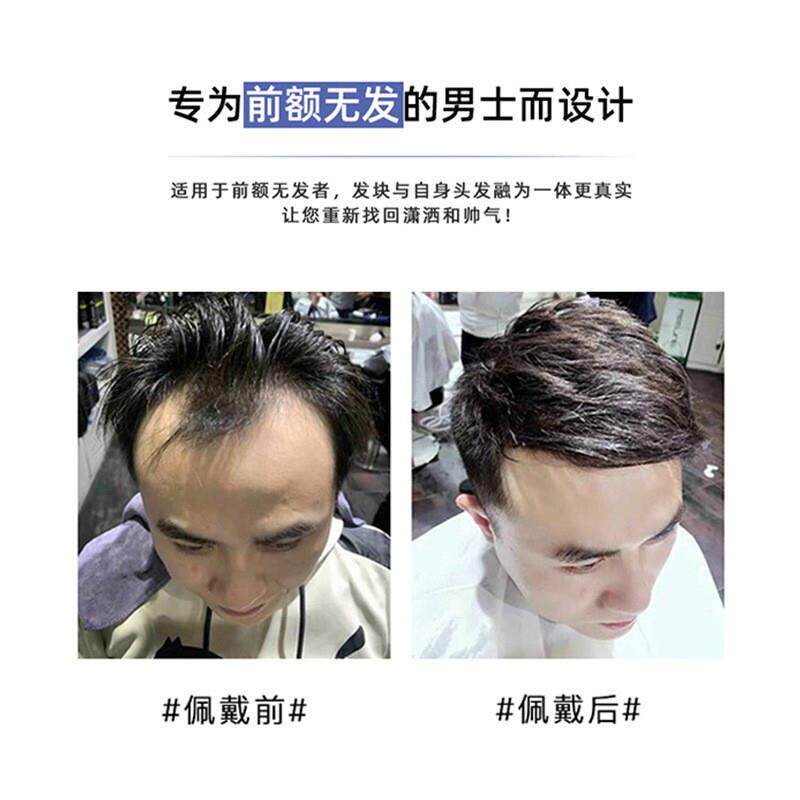 发际线贴前额补发片男士生物头皮假刘海隐形无痕逼真背头真人发