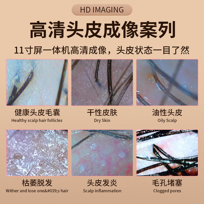 头皮检测仪毛囊高清理髲店头发测试仪器皮肤面部分析带屏幕All