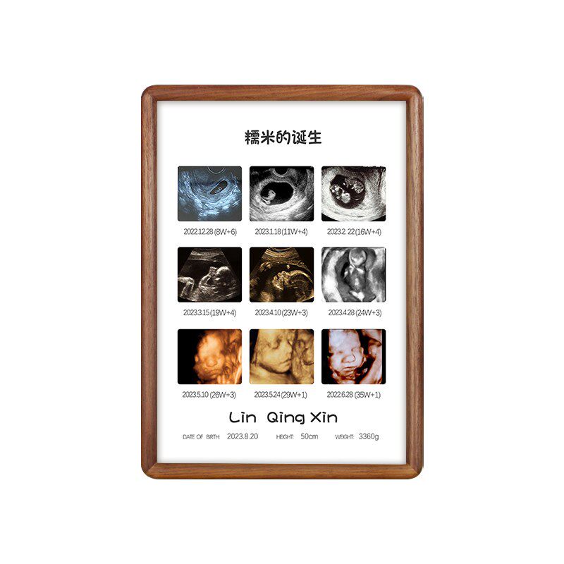 孕期B超单相框宝宝照片组合定制DIY父亲节礼物画框孕妇照片打印