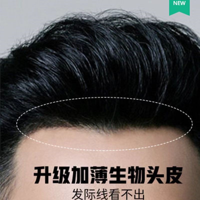 男士假发补发片全真发生物边全递针前额超薄隐形手工编织全网爆品
