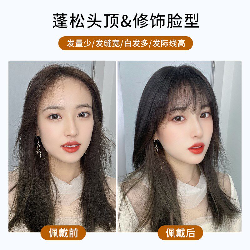 【王菊推荐】瑞家假发片女头顶增发量真发全真人高颅顶隐形补发片