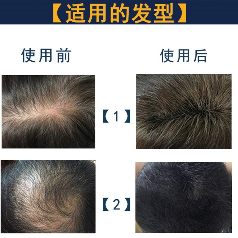 天空之发头发纤维粉喷雾密发增发头顶遮稀发缝发际线秃发补发神器