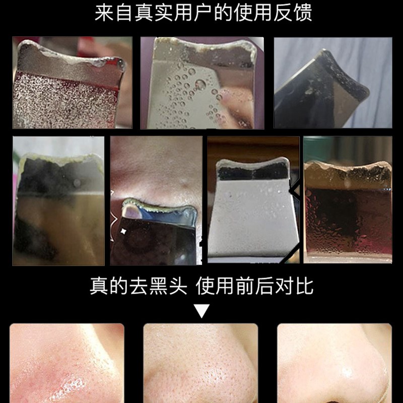 超音波黑头铲美容院去黑头仪皮肤深层清洁铲子铲皮刀铲皮机美容仪