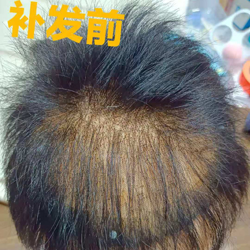 假发片男短发 全真人发 头顶补发片 修补染色修剪