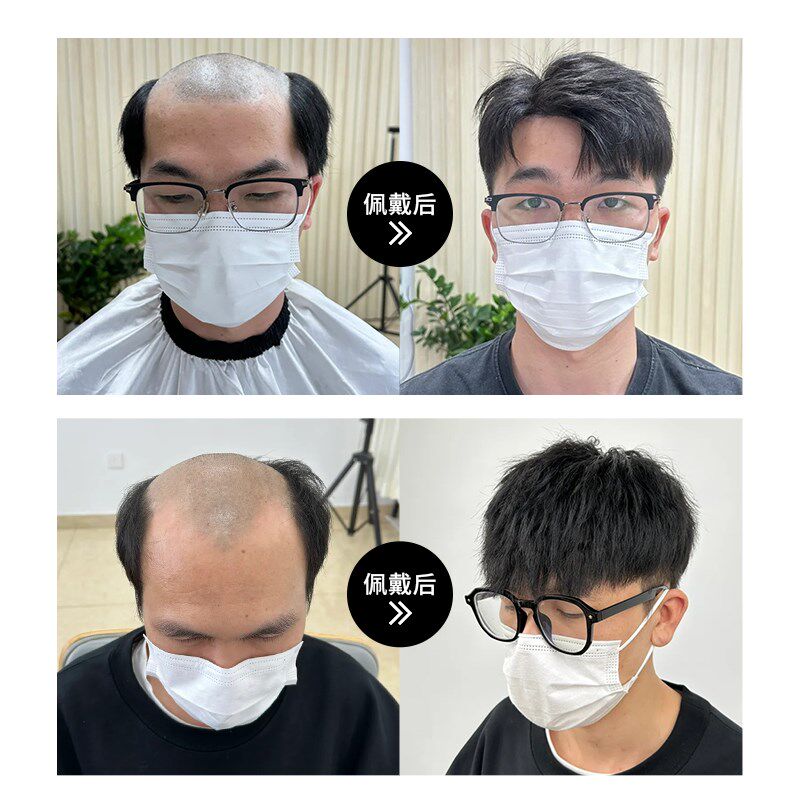 男士假发头顶补发蓬松自然全真发四周生物头皮遮白发递针网假发片