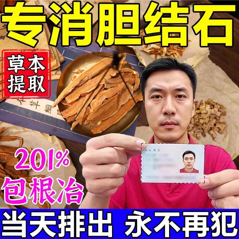 胆结石溶石化石排石专用药排胆囊结石溶石茶茶鸡内金化石草特效药