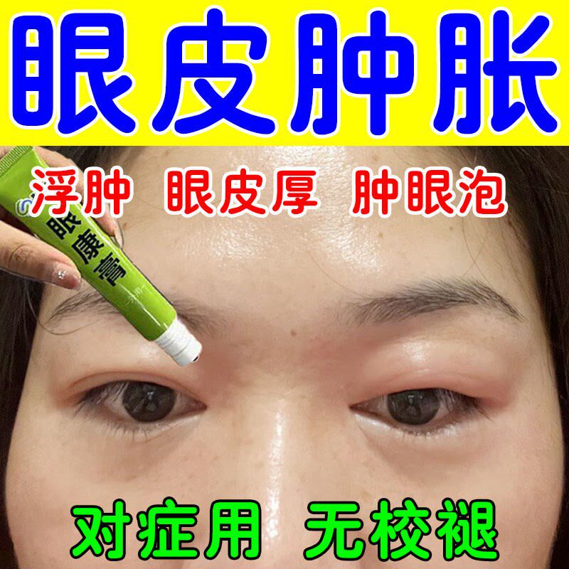 【对症使用】眼皮水肿浮肿睡醒肿眼皮脂肪厚肿眼泡上眼皮红肿专用