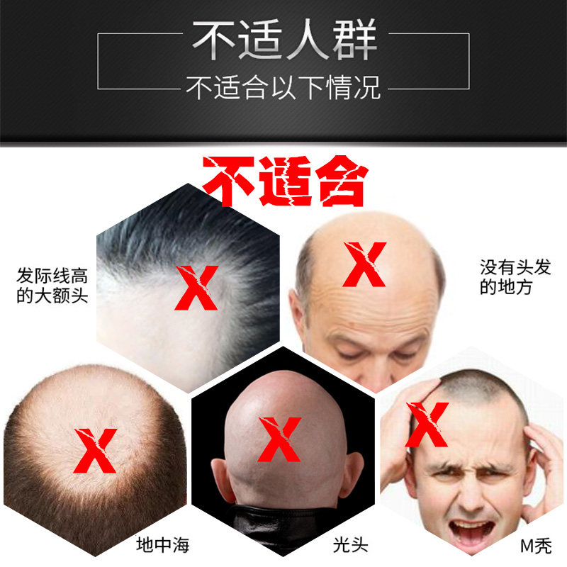 景芃头发纤维视觉补发密发喷雾头发稀疏男女假发修掩饰用增发纤维
