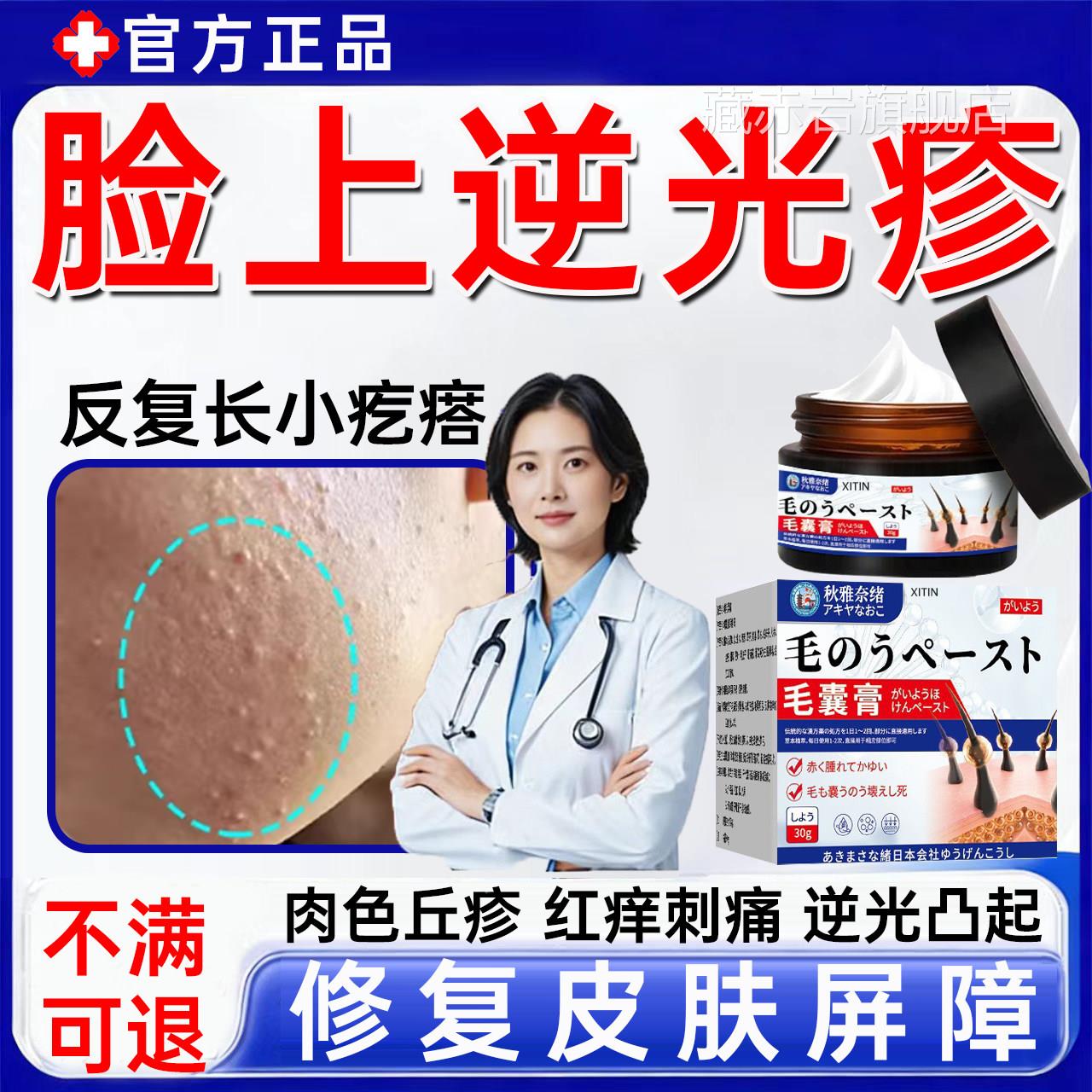 脸上逆疹起小疙瘩修复软膏额头小颗粒毛囊光堵塞闭口粉刺激素脸UU