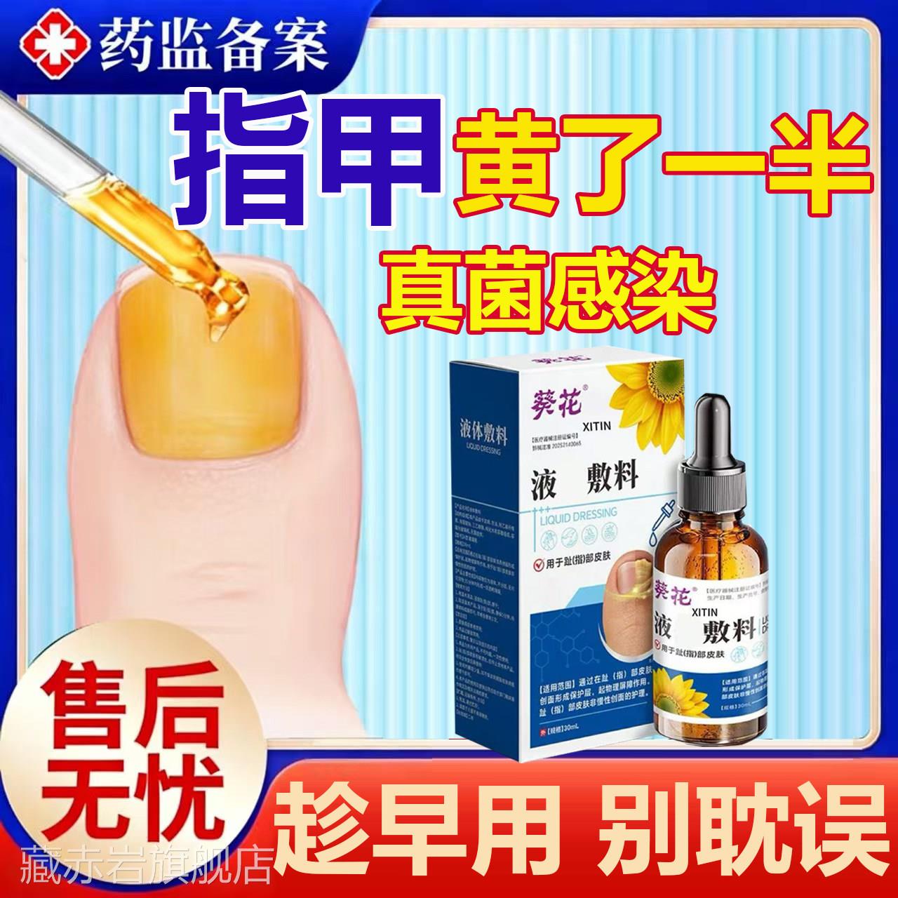 脚甲发黄指增厚变空形软化分层灰指甲盖脱甲膏专用神器真菌感染MR