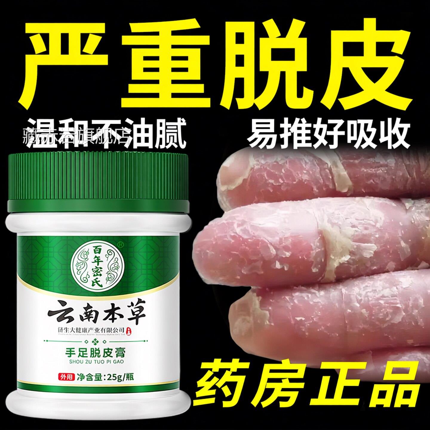 手足脱指皮膏手头裂口子脱皮开裂抑菌膏起皮干燥手掌蜕皮掉皮专用