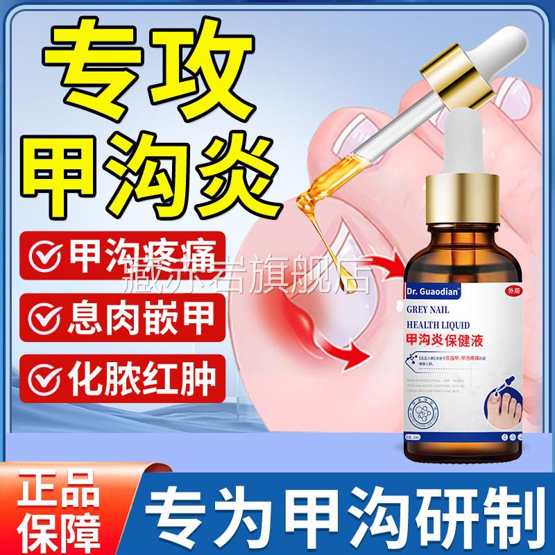 甲沟炎软甲嵌甲去肉芽息肉脚趾矫正软器消肿化脓化剂抑菌水旗舰店