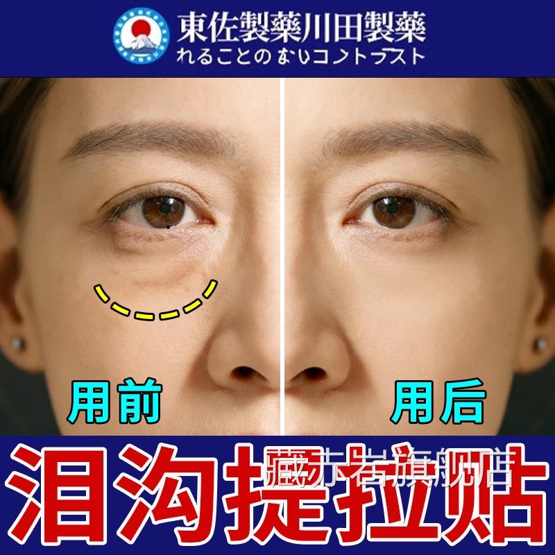 泪沟提拉贴紧日本进口神器眼窝凹i陷修复袋致抗皱淡化小熨斗正品