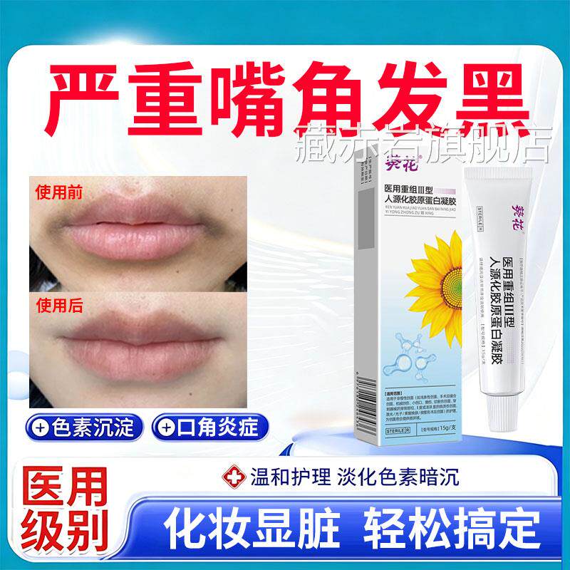 改唇周黑嘴角发黑去除嘴巴周边黑唇膜去死皮淡化唇纹夜善间修护颜