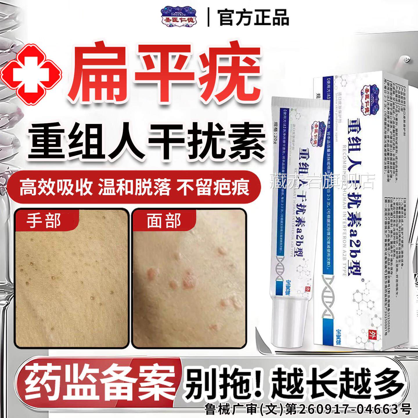 重组人干扰素a2b扁平疣专用去除软膏一灵去b2根凝胶官抹方旗舰店