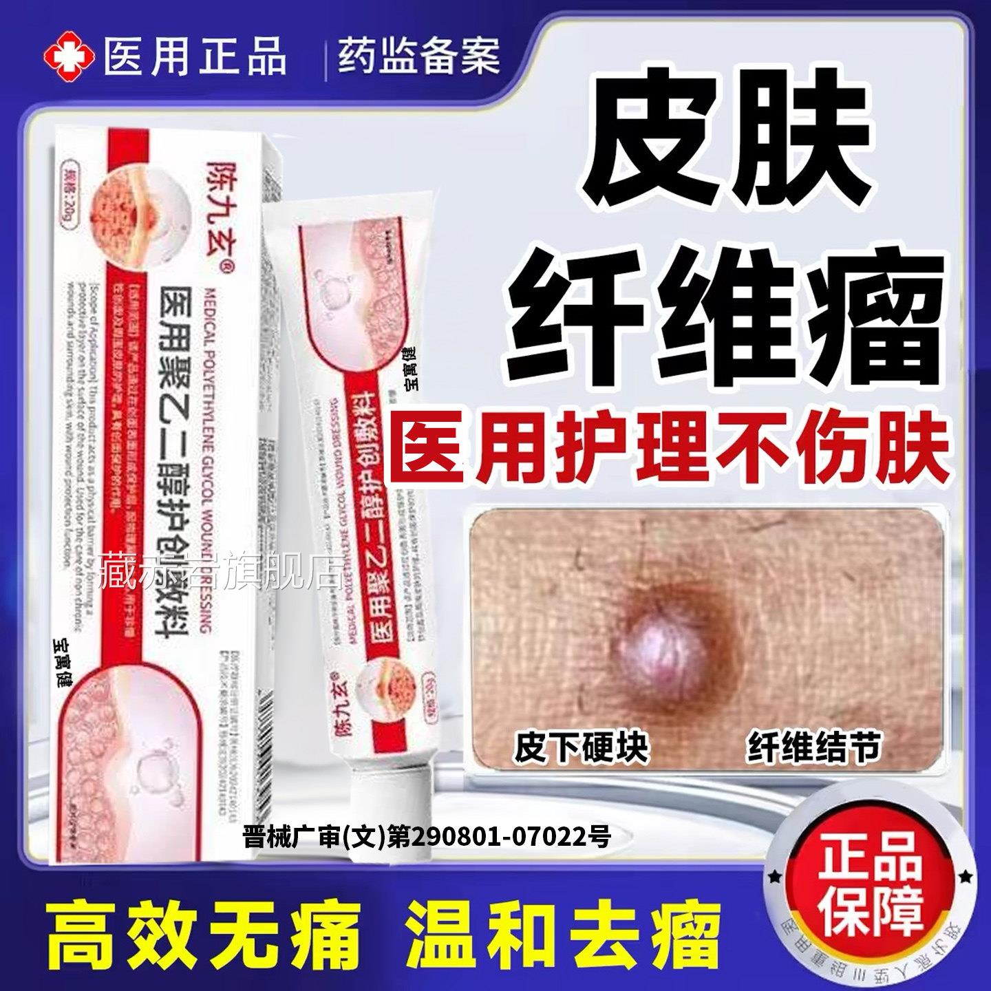 陈九玄脂肪方瘤消瘤膏去除神器皮下硬块皮肤纤维脂腺囊肿官旗舰店