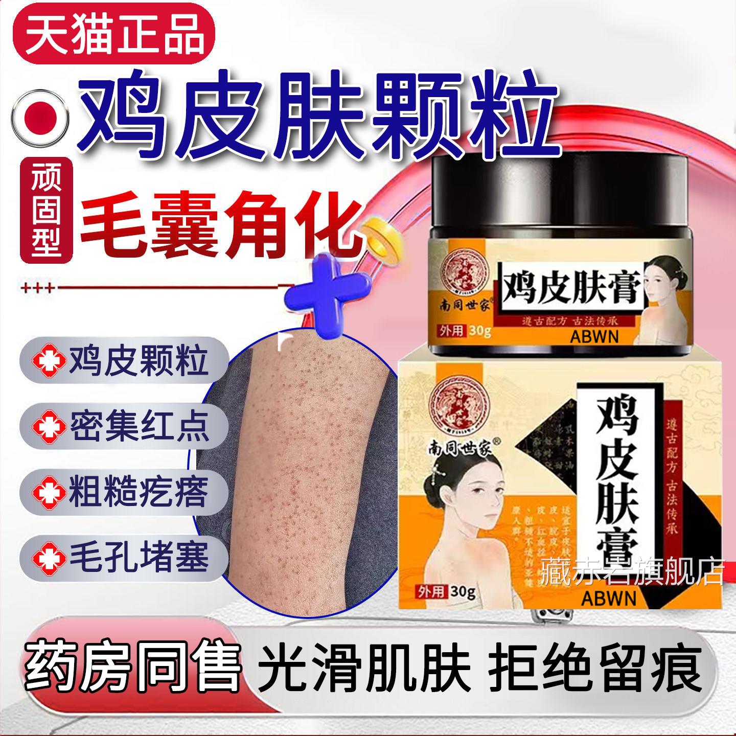 鸡皮肤疙瘩器毛囊角化药膏去除全身手臂腿神专药用粗糙红点干燥症