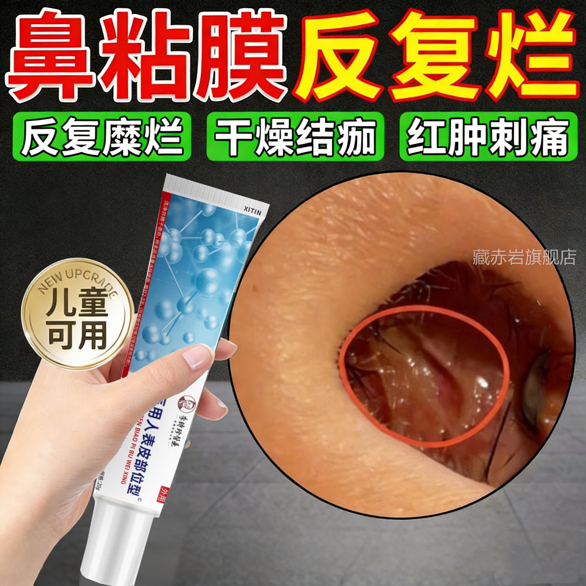 鼻中隔鼻腔溃疡上火鼻子生疮结痂鼻黏糜烂干燥性鼻炎修复药膏P膜P