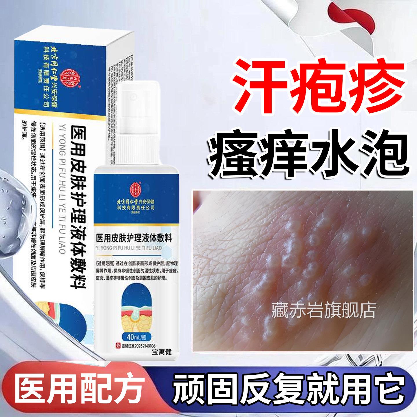 汗疱疹专水用膏药脚底手上起小泡又痒又脱皮止痒去汉状真菌感染藏