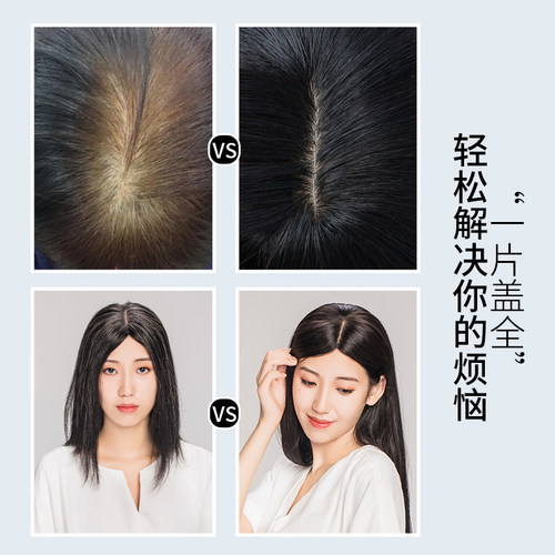 遮白发假发片真发头顶补发块轻薄无痕蓬松盖发顶中分八字假刘海女