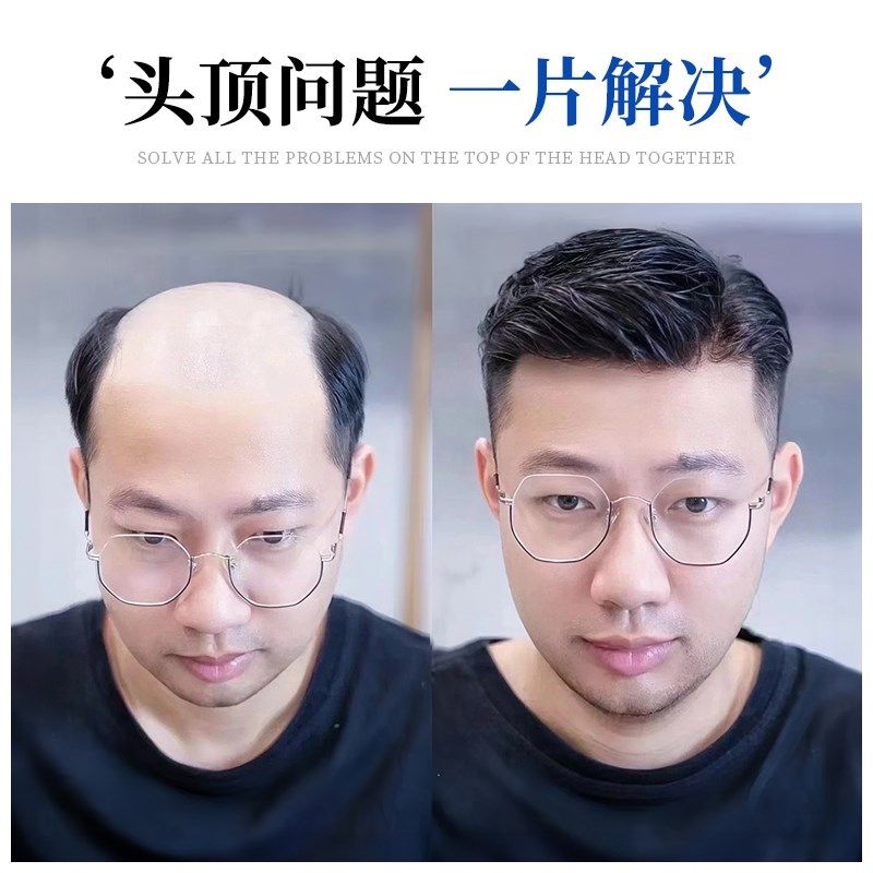 美禾假发男士真人发丝头顶脱发手织补发块中年男式毛寸无痕补发片