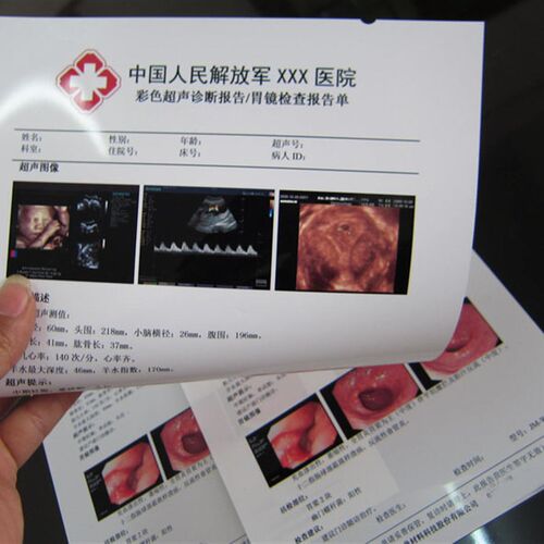 医院用胶片瓷白喷墨片胶片A4胶片胃镜B超四维彩超打印纸100张