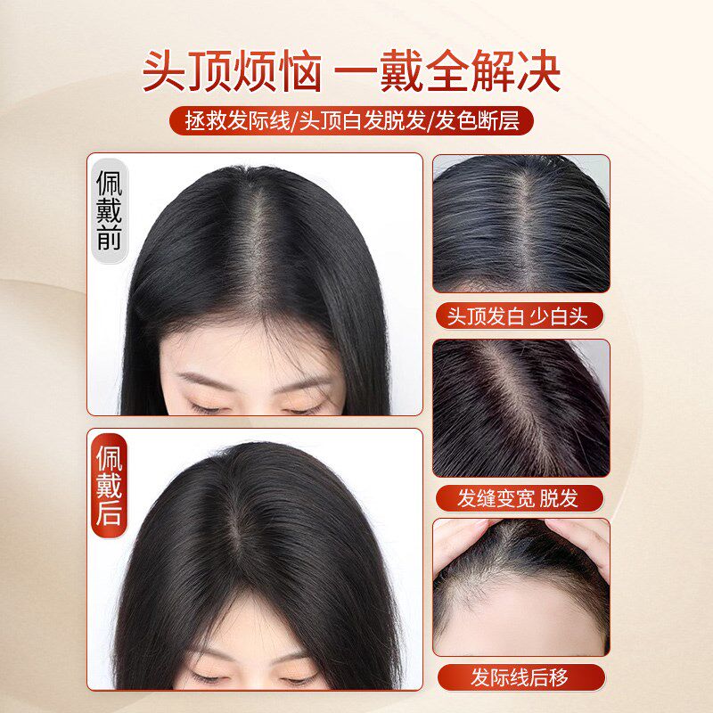 递针假发女片头顶真发增发量蓬松高颅顶遮白发自然前额刘海补发片