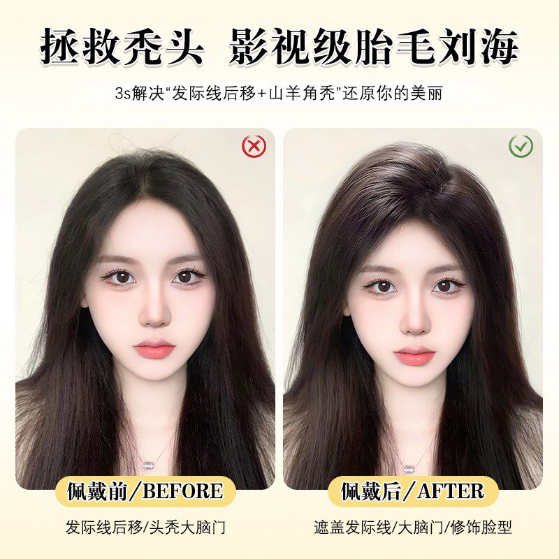胎毛刘海假发片女头顶真发自然轻薄蓬松高颅顶隐形前额鬓角补发片