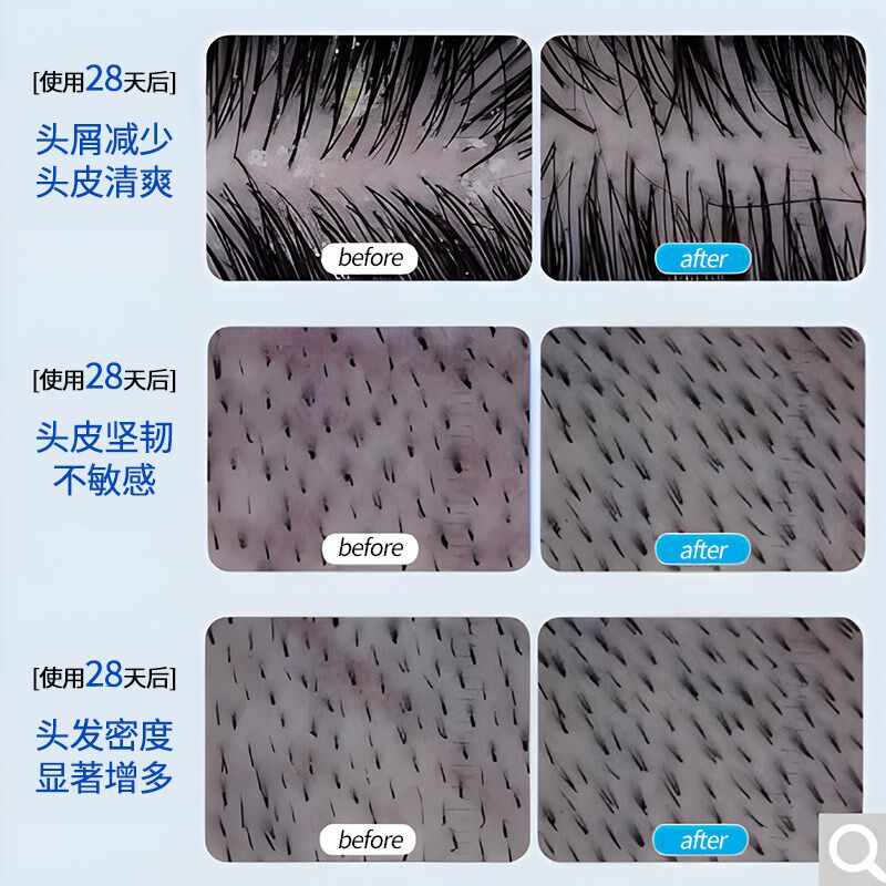 妮雀娜头皮鲜养梳红蓝光生发梳子电动按摩健发生发仪