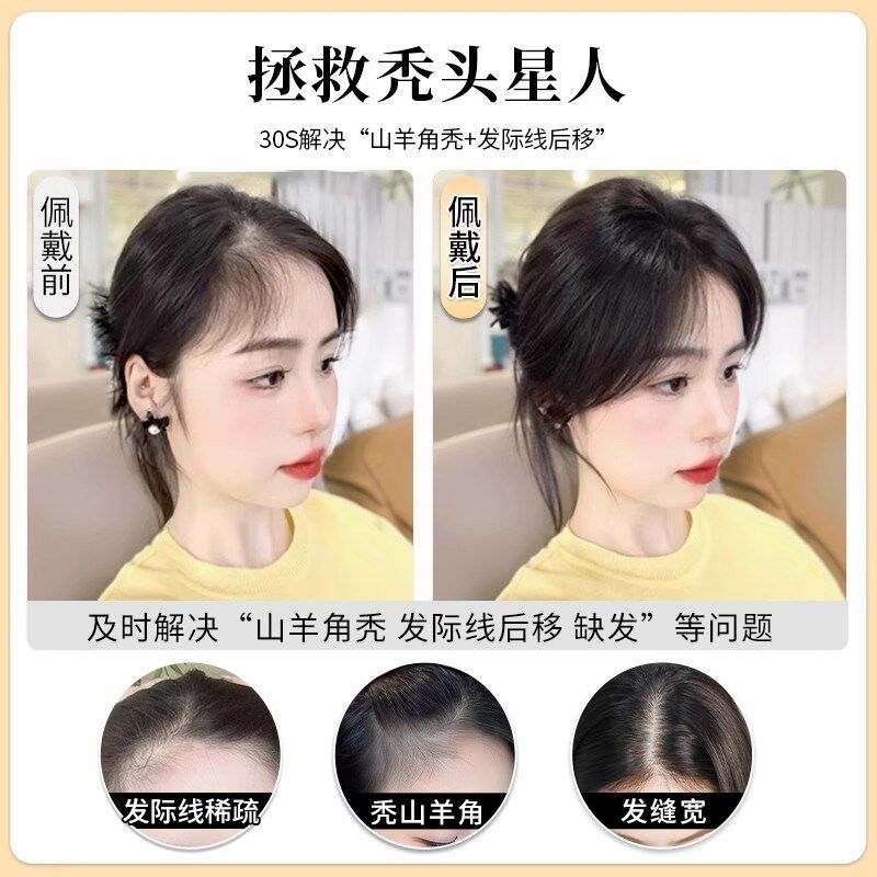 胎毛浏海假发女片头顶遮秃顶神器高颅顶蓬松真发无痕发际线 线假