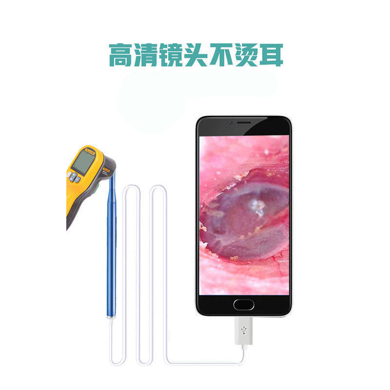 可视挖耳勺手机版发光采耳镜专业掏耳朵神器高清内窥镜儿童抠耳屎