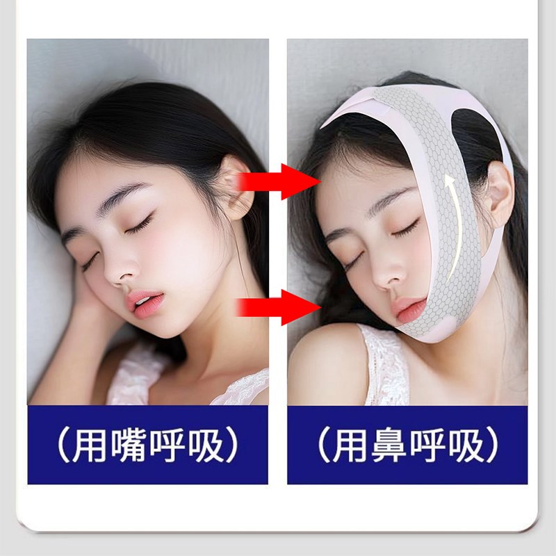 口呼吸矫器正儿童睡觉防张嘴腺样体肥大面容纠带张口闭嘴正神器贴