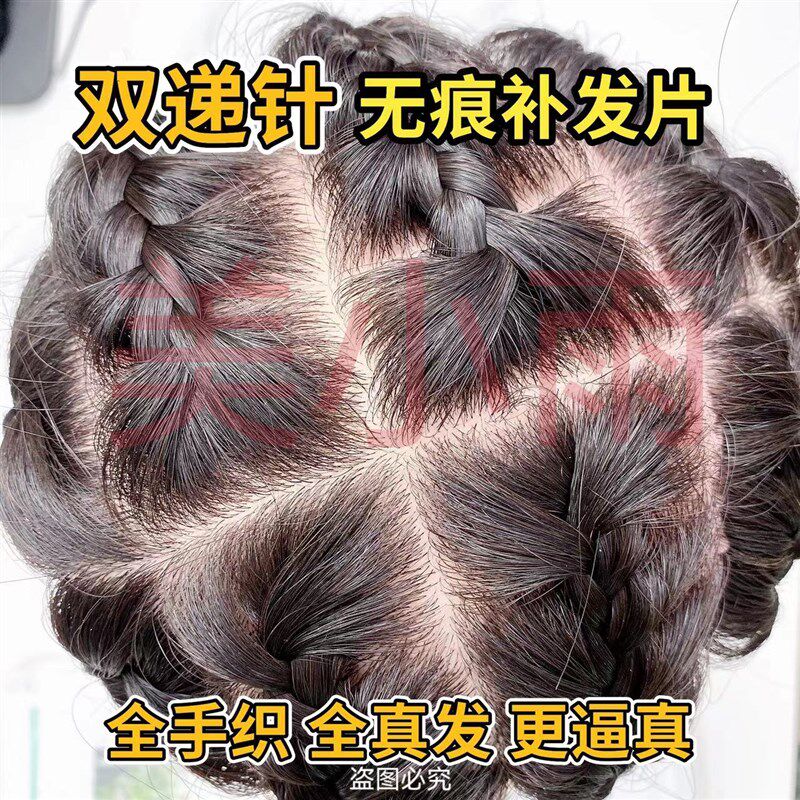 真发双递针头顶补发片假发女士无痕遮白发秃顶增发量蓬松轻薄无痕