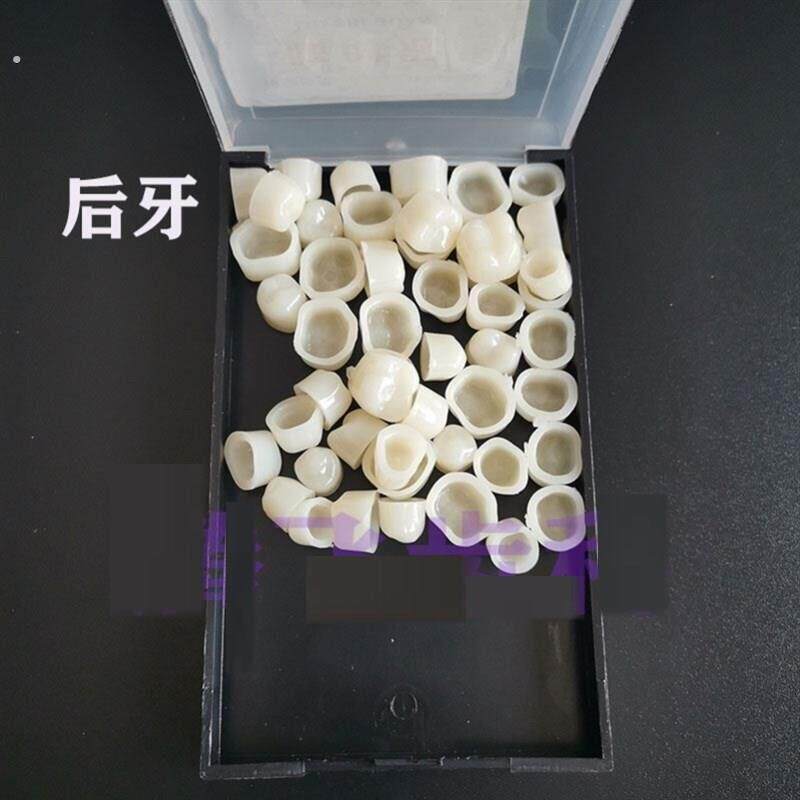 单个牙套一颗牙假牙套牙彷真牙齿遮丑门牙临时牙套缺牙吃饭防塞
