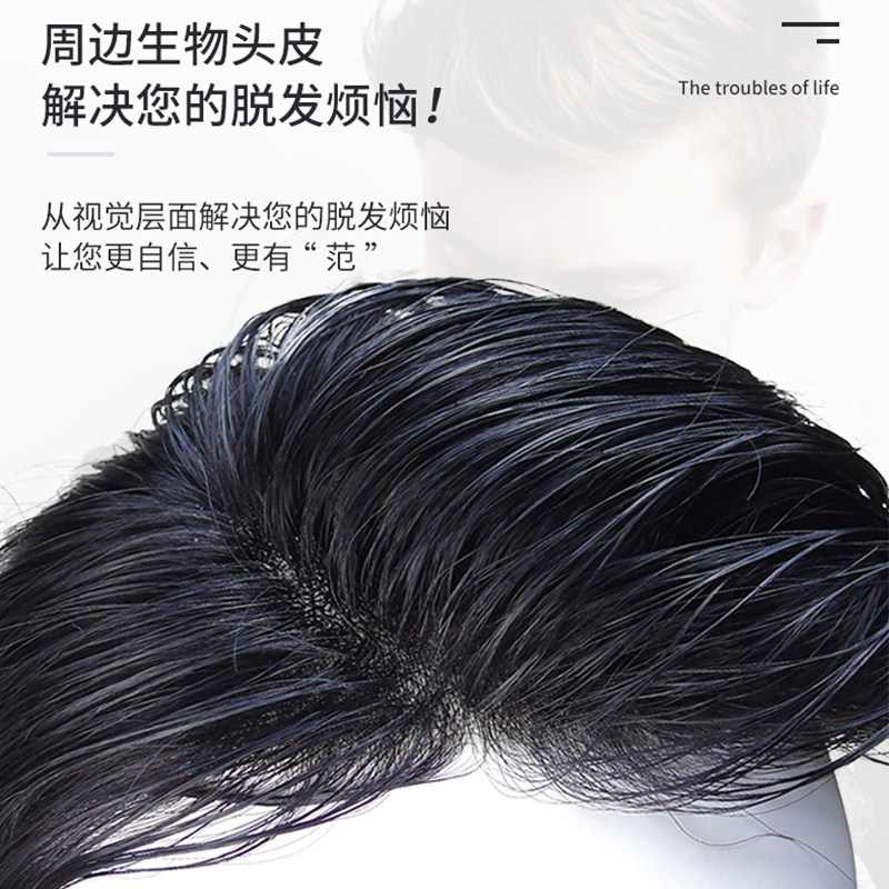 假发男头顶补发男短发真发隐形中分发际线发块毛寸发顶男士假发片
