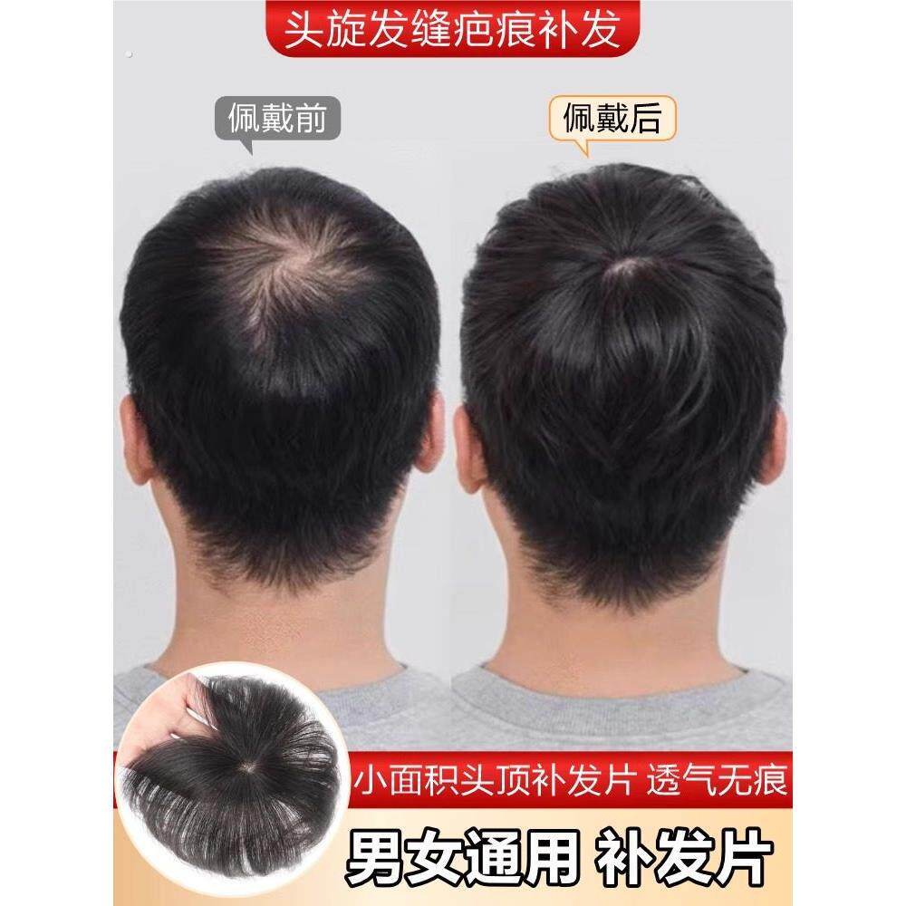 假发片男士头顶补发片全真发头旋发缝遮盖伤疤稀少脱发后脑勺女士