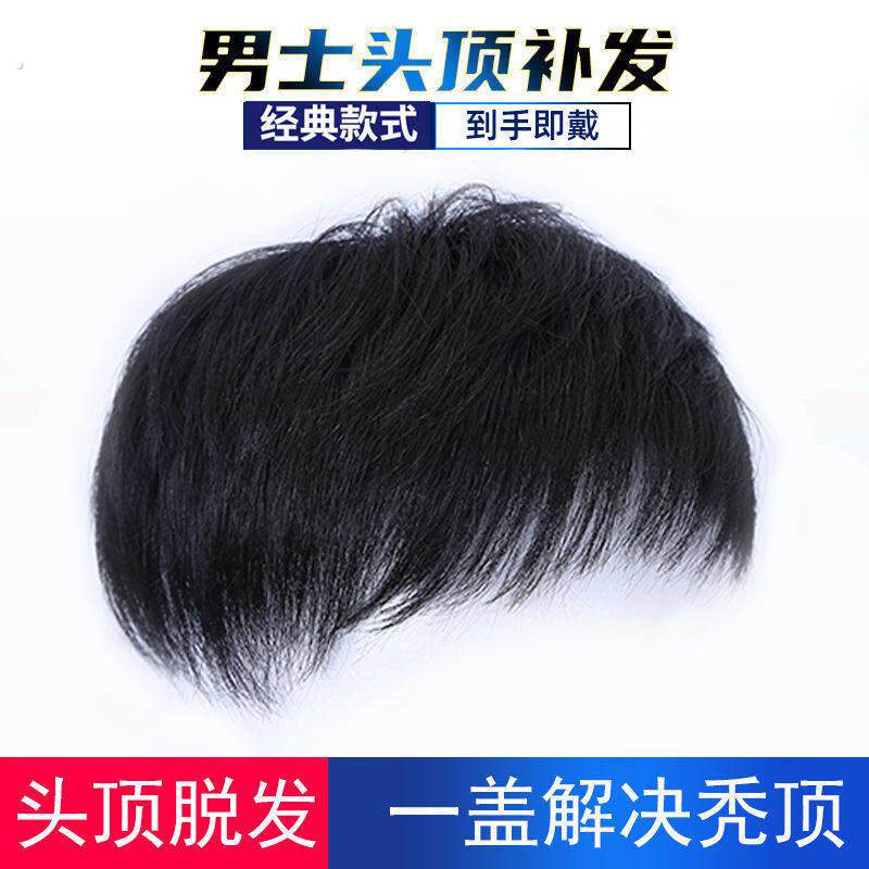 假发男短发头顶补发块秃顶地中海假发片贴男士毛寸彷真发韩版帅气