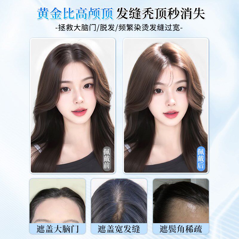 假发女片头顶全真发高颅顶发际线假发帖自然前额无痕蓬松八字刘海