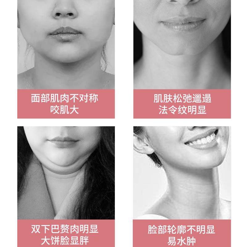 推脸神器脸部按摩器瘦脸神器滚轮双下巴咬肌按摩器提拉紧致脸面部
