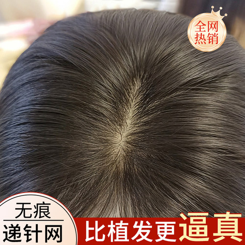 递针假发片女头顶增发量真发蓬松高颅顶无痕N遮白发八字刘海补发