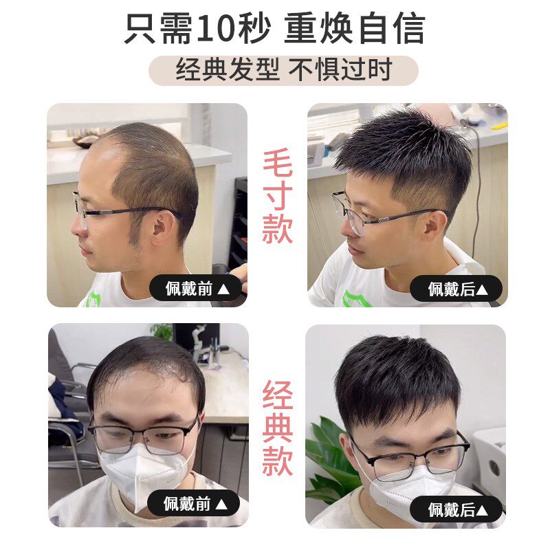 假发男生发片男士无痕隐形全真发短发型毛寸自然头顶补发片光头