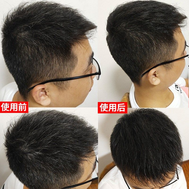 一次性补色棒纯天然植物补染笔遮掩鬓角发根头顶白发变黑神器男女