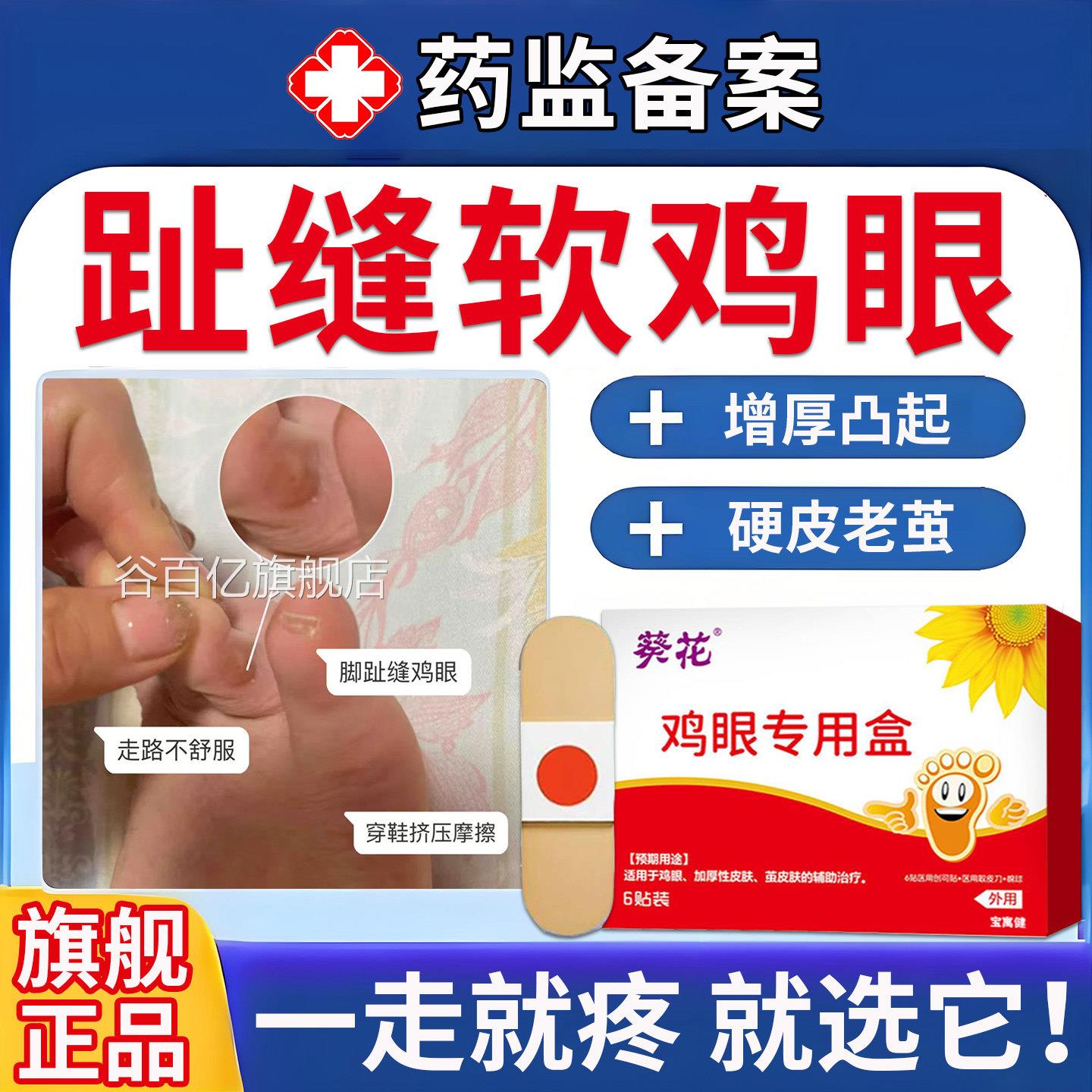 鸡厚眼贴无痛除老茧治疗茧皮肤增专用官方旗舰店正品医用级谷百亿