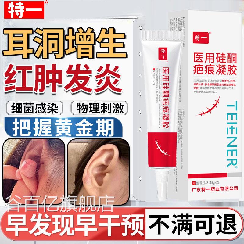 去耳洞增生除硅酮疤痕修复疤第凝胶膏一名凸起硬肉疙瘩旗舰店正品