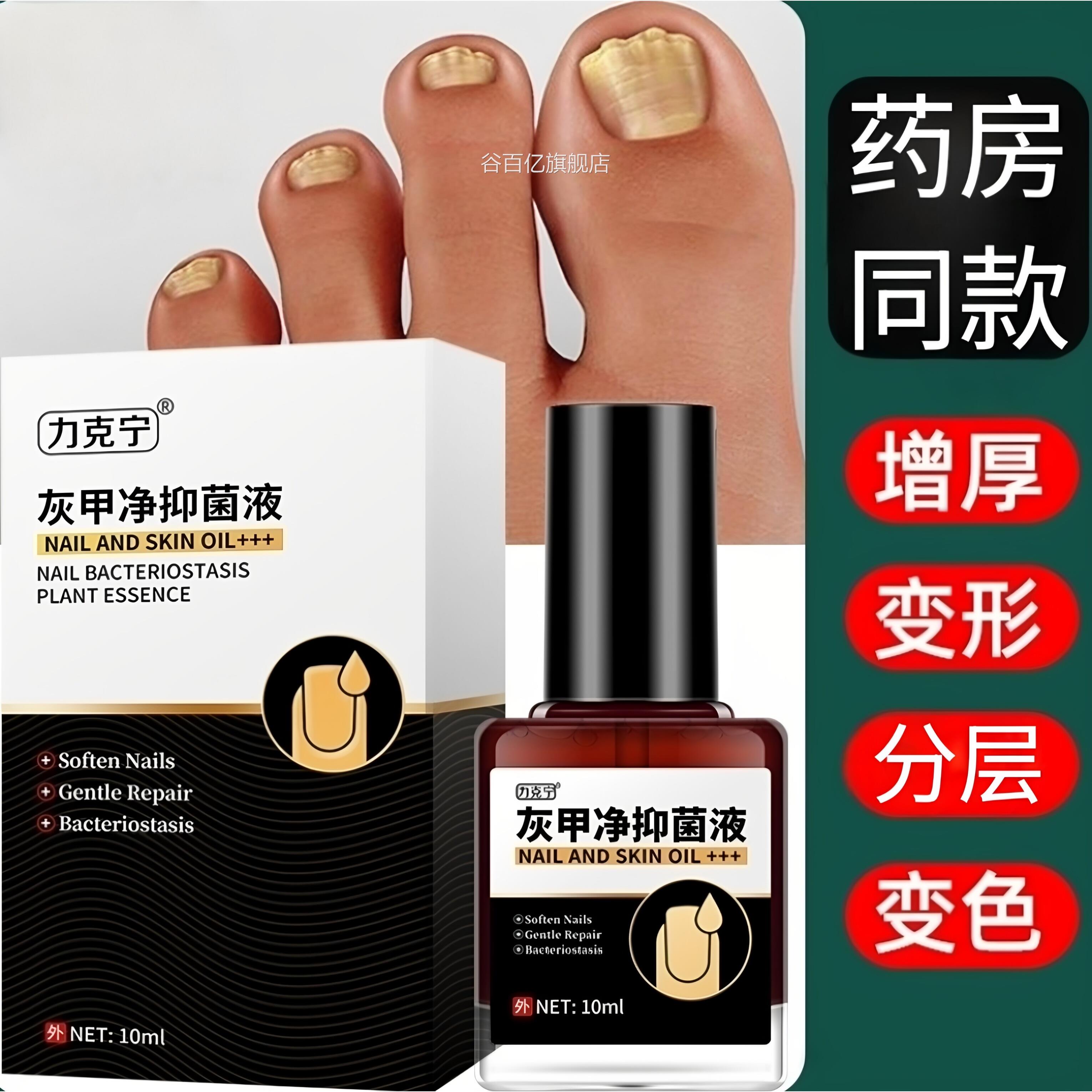 力克宁抑菌液灰指甲液专用抑菌灰指甲软甲去增厚膏脱甲膏灰指甲液